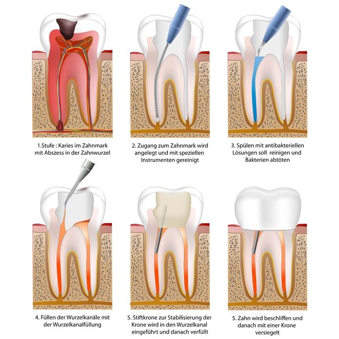 Endodontie & Endodontologie Spezialist Zahnarzt Dr. Schwindler